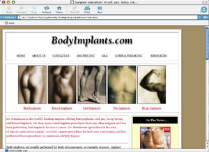 bodyimplants.com