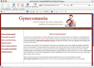 gynecomastia site